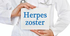 Estudo observacional demonstra que COVID-19 pode aumentar risco de herpes zoster em pessoas com mais de 50 anos