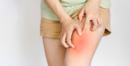 Urticária espontânea crónica afeta mais a qualidade de vida que dermatite atópica e psoríase