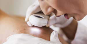 Hospital Garcia de Orta instaura primeiro CRI em Dermatologia do país