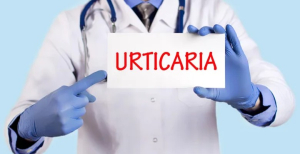 Farmácias promovem campanha nacional de rastreios à urticária crónica espontânea